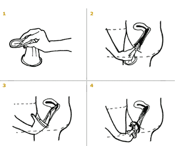 femidom-illustration.gif