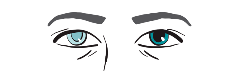 illustration-af-oejnesygdom.png
